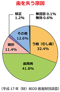 歯を失う原因